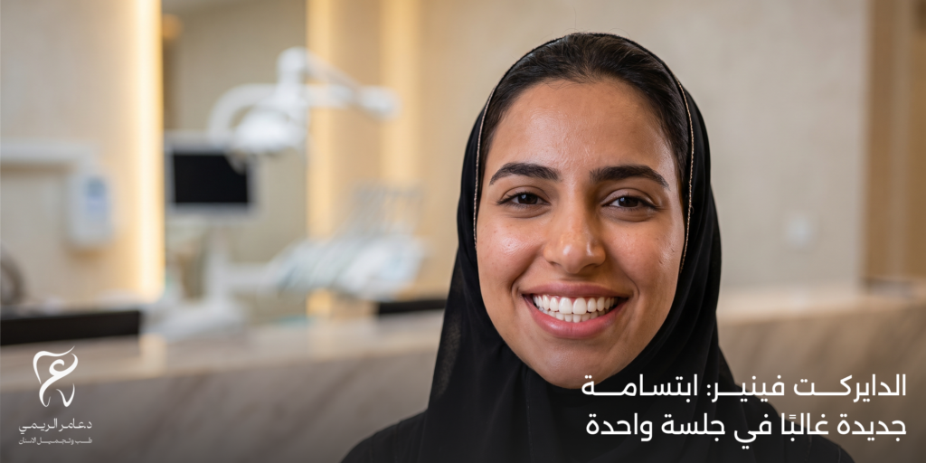 الفرق بين الفينير والدايركت فينير